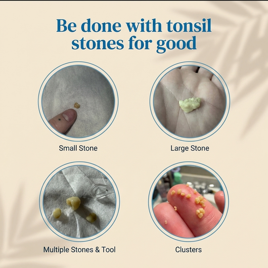 Oralieve Tonsil Stone Cleaner
